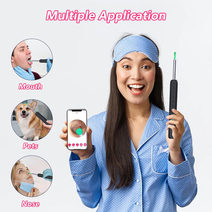 Wireless Ear Cleaner with Camera – USB-C Rechargeable Otoscope Earpick, Wax Removal Endoscope Tool with Mini Camera