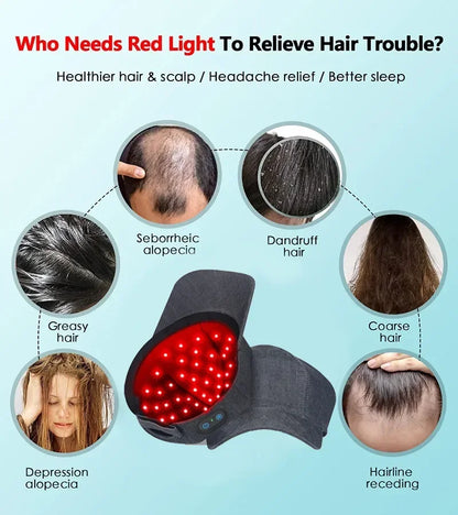 Rechargeable Hair Growth Cap – 2000mAh LED Device for Anti-Hair Loss, Stress & Anxiety Relief, Migraine Reduction, Scalp Massager