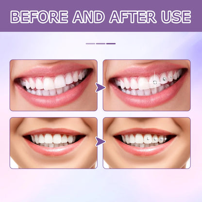 Tooth Gem Glue Dental Adhesive for Diamond Crystals & Jewelry | Sturdy Orthodontic Gel for Teeth Gems