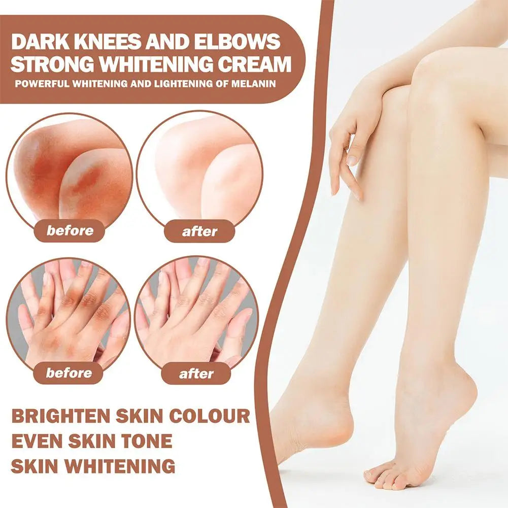 Skin Brightening Cream – Dark Spot Corrector for Underarms, Knees & Inner Thighs, Even Tone Whitening Serum for Intimate Area Care