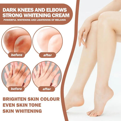 Skin Brightening Cream – Dark Spot Corrector for Underarms, Knees & Inner Thighs, Even Tone Whitening Serum for Intimate Area Care