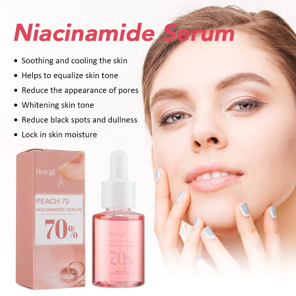 30ml Niacinamide Serum – Dark Spot Corrector, Melanin Removal & Pore-Shrinking Hydrating Skin Care