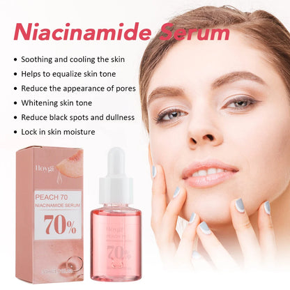30ml Niacinamide Serum – Dark Spot Corrector, Melanin Removal & Pore-Shrinking Hydrating Skin Care
