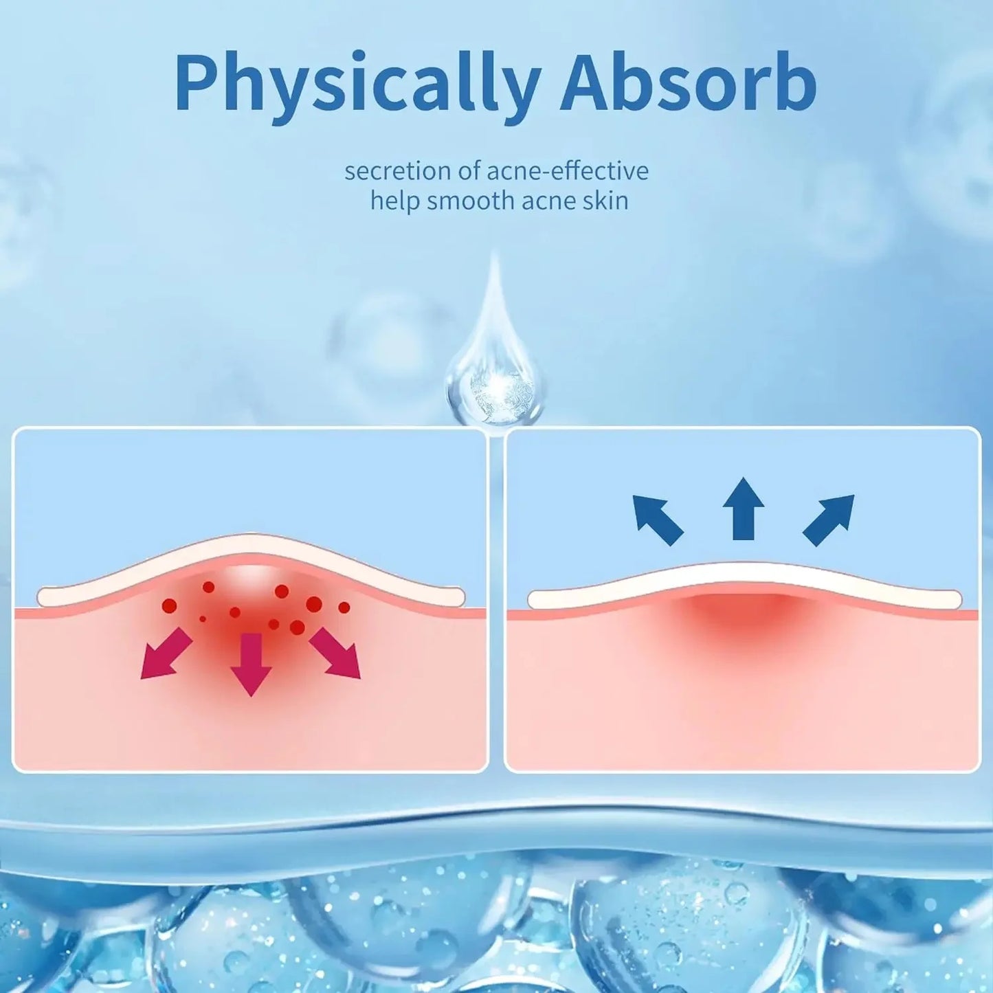 180/360PCS Invisible Acne Patches - Pore Cleansing Oil Control & Skin Smoothing Facial Stickers