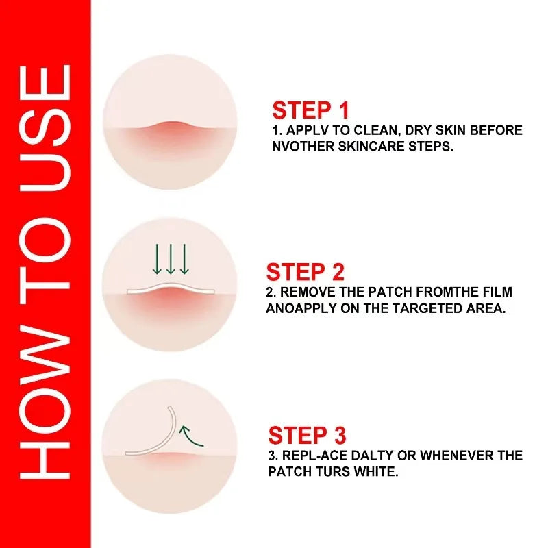24-Piece Hydrocolloid Acne Patches - Invisible Pimple Spot Stickers in S/M/L Sizes for Face and Body Blemish Coverage