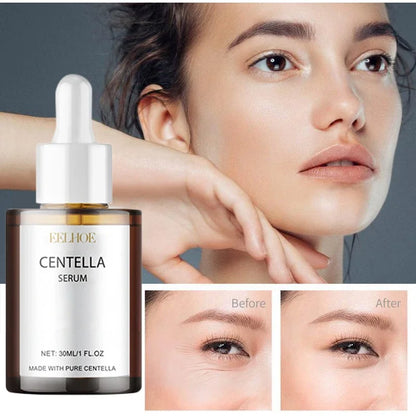 Centella Asiatica Face Serum – Nourishing, Brightening & Moisturizing Cream for Dry Skin Rejuvenation