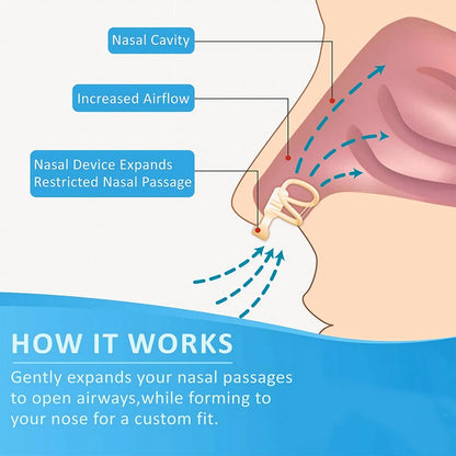 Silicone Nose Dilator Clip – Anti-Snoring Device for Easy Breathing & Improved Sleep
