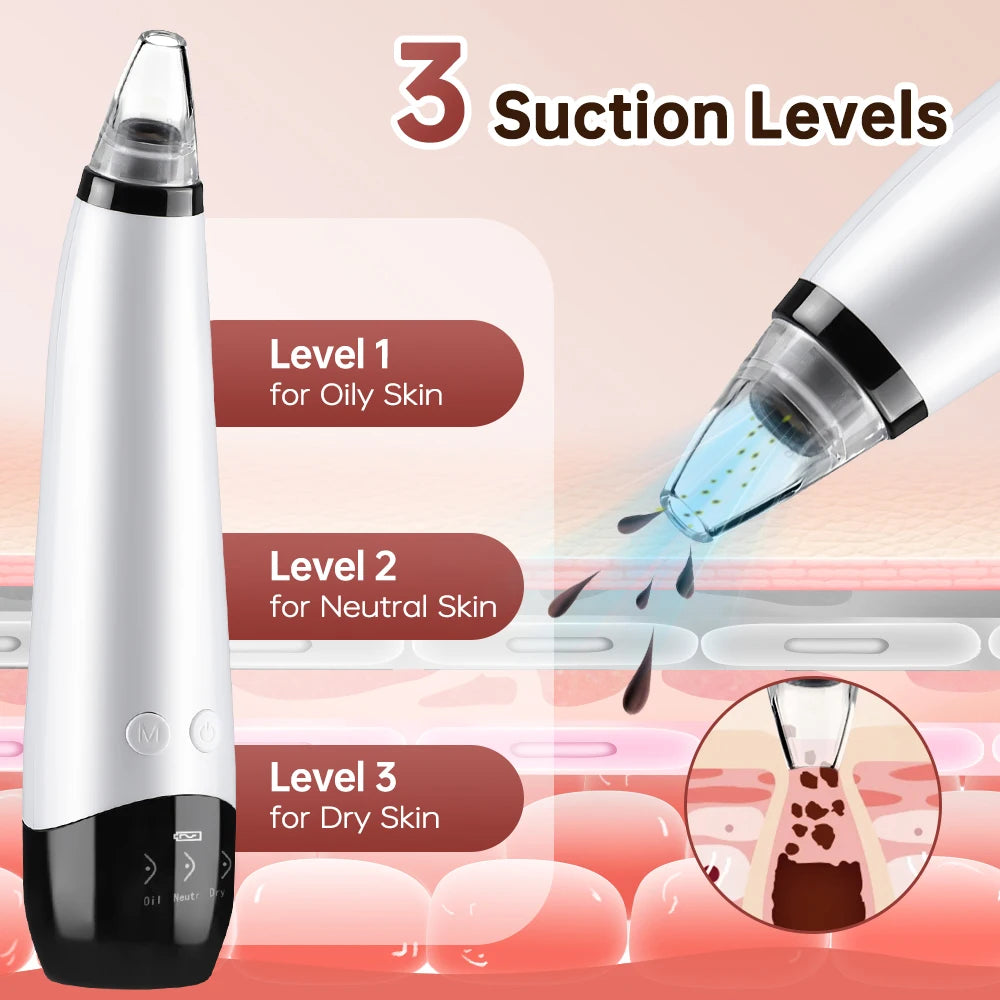 3-Mode Blackhead Remover Vacuum – Facial Pore Cleaner & Dead Skin Removal Beauty Tool