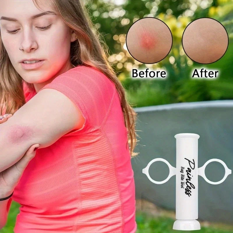 Bug Bite Suction Tool - Venom Extractor for Itch & Swelling Relief, Bite and Sting First Aid for Hiking & Outdoor Use