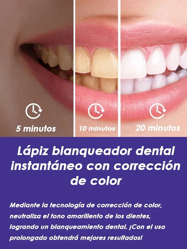 Purple Teeth Whitening Pen - Stain Removal Toothpaste Treatment for a Brighter Smile & Fresh Oral Care