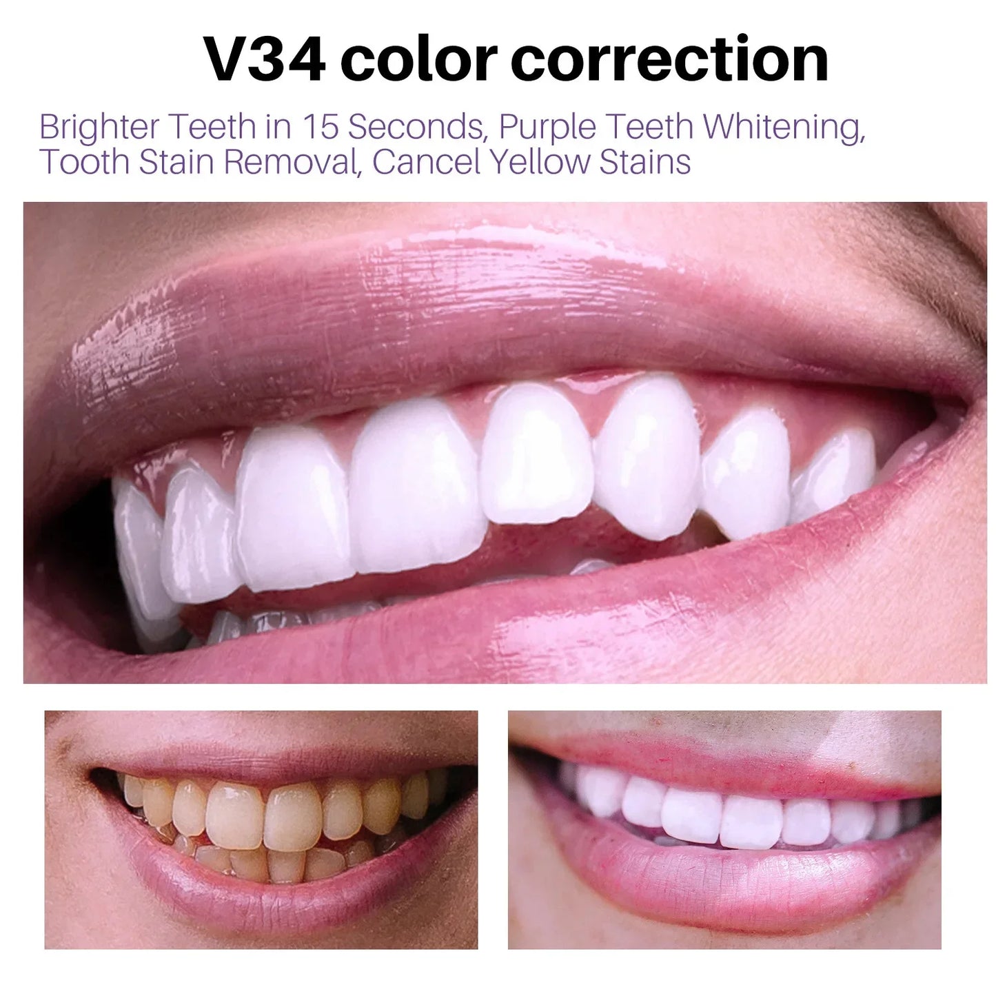 Teeth Whitening Toothpaste – Fruit Acid Formula for Plaque Removal, Stain & Calculus Cleanser, Fresh Breath & Oral Hygiene