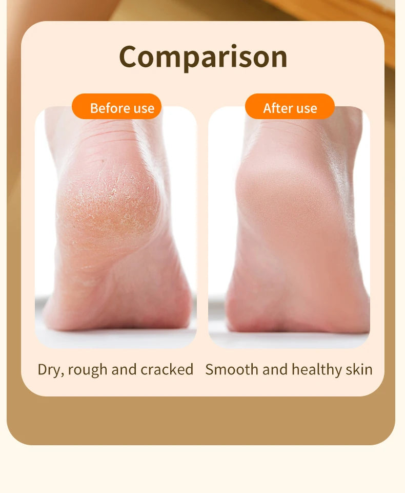 HOMFISH Electric Foot Grinder – Automatic Callus Remover Pedicure Machine for Smooth and Beautiful Feet