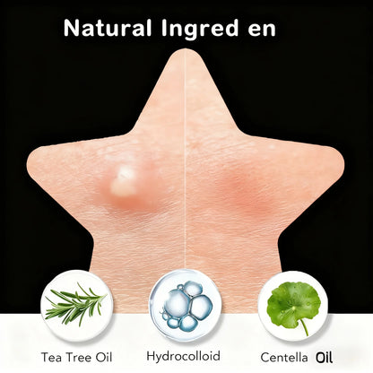 Black Star Hydrocolloid Pimple Patches - Bulk Acne Stickers with Tea Tree Oil, 240/480/800 Pieces