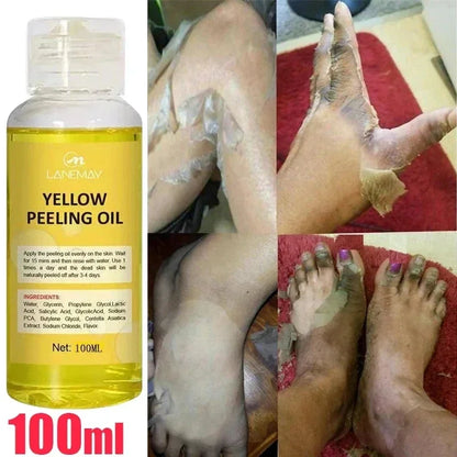Body Care Exfoliating Yellow Peeling Oil – 100% Organic Dark Skin Whitening Serum for Dark Knuckles and Fast Bleaching