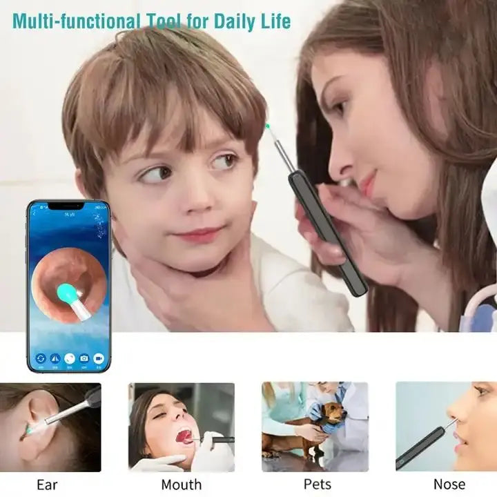 Wireless Smart Visual Ear Cleaner – 1296P Camera Otoscope Ear Wax Removal Health Care Kit