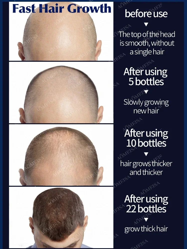 Rapid Hair Growth Serum – Beard, Chest & Body Hair Enhancer for Fuller, Thicker Growth