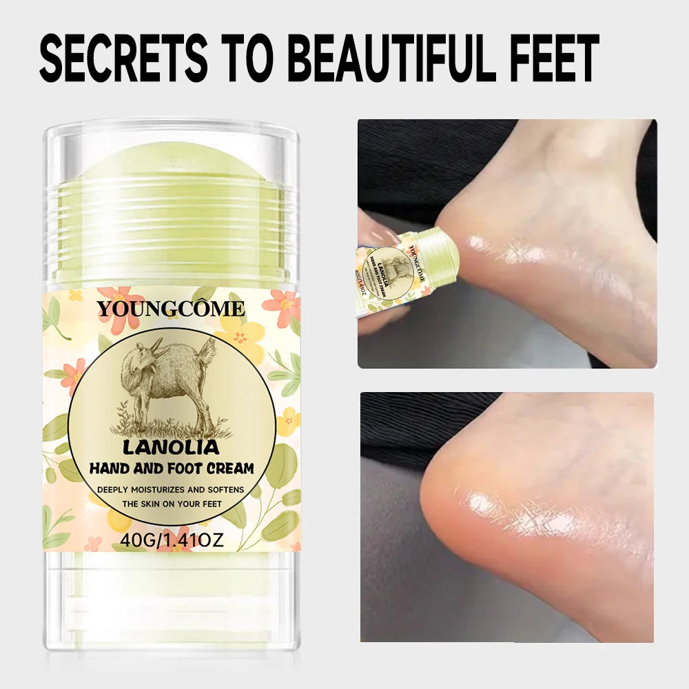 YOUNGCOME Hand & Foot Cream – Deep Moisturizing Repair for Dry, Cracked Skin | Hydrating Softening Lotion