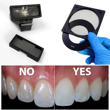 Godox MF12 Dental Photography Polarizer Kit Cross-Polarization Flash Set for Reflection-Free Intraoral & Clinical Imaging