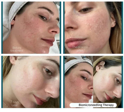 10pcs Sponge Microcrystal Freeze-Dried Collagen Powder — Natural Sponge Spicules for Skin Cell Renewal