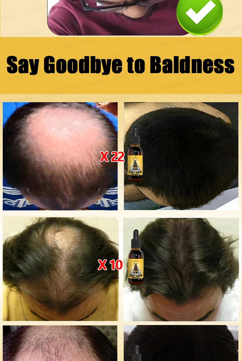 Rapid Hair Growth Serum – Beard, Chest & Body Hair Enhancer for Fuller, Thicker Growth