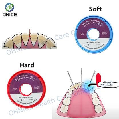 Orthodontic Retainer Chain Wire - 1m Stainless Steel Spool for Post-Braces Dental Retention