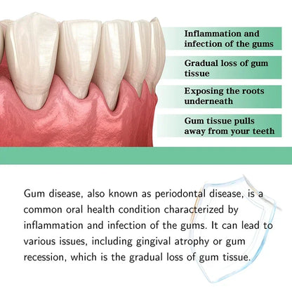 30ml Gingival Repair Drops – Fast Treatment for Cavities, Receding Gums & Gum Pain Relief