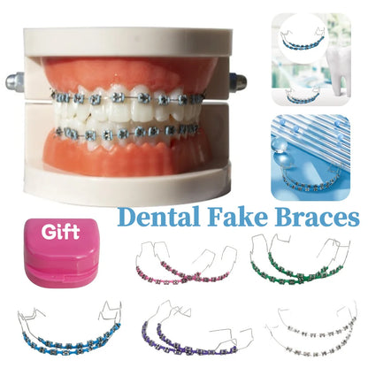 Fashion Temporary Tooth Braces – High-Quality Dental Fake Braces with Metal Wires and Brackets
