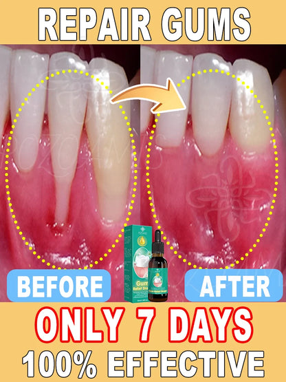 2025 Advanced Gum Care Device — Powerful Technology to Eliminate Gum Recession, Bleeding, and Tooth Pain