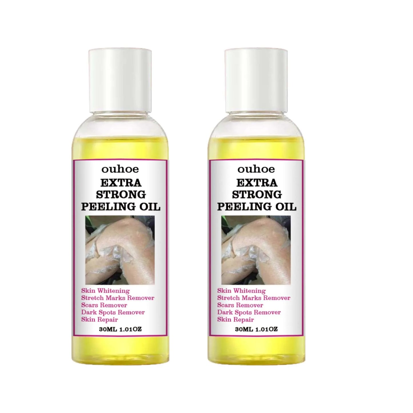 30/110ml Super Strength Body Peeling Oil — Brightening, Moisturizing & Exfoliating Skin Care Oil