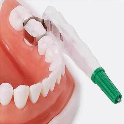 Preformed Dental Matrix Bands – Adjustable Sectional Matrix System for Crowns