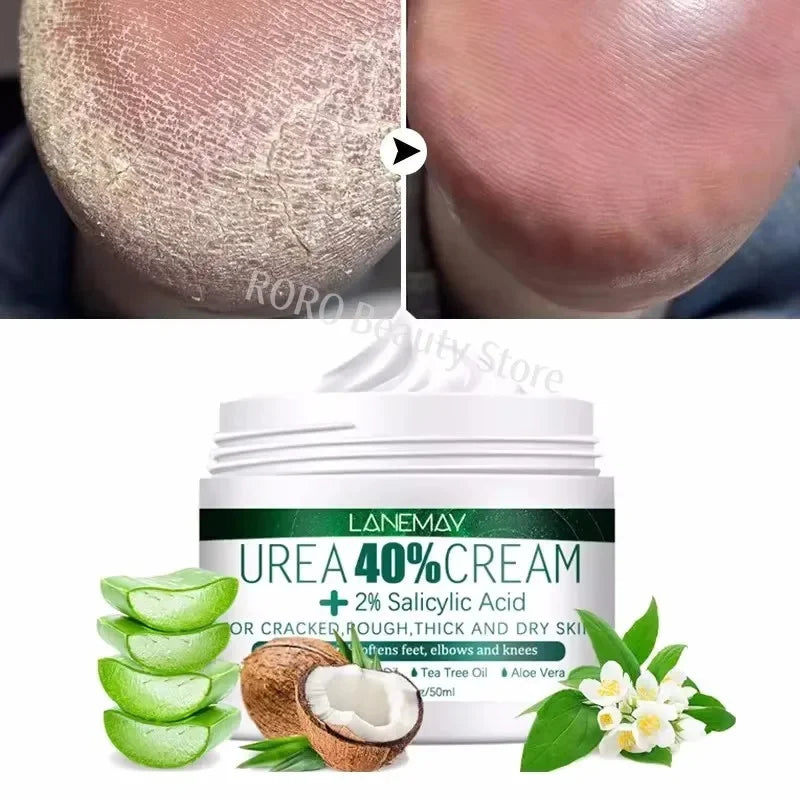 Herbal Heel Repair Foot Cream – Cracked Heel Care, Dead Skin Exfoliation & Deep Moisturizing for Soft, Smooth Feet
