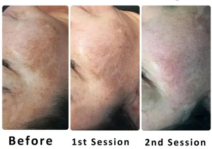 10pcs Sponge Microcrystal Freeze-Dried Powder Collagen Regeneration Sponges – Natural Biological Extract for Skin Cell Renewal