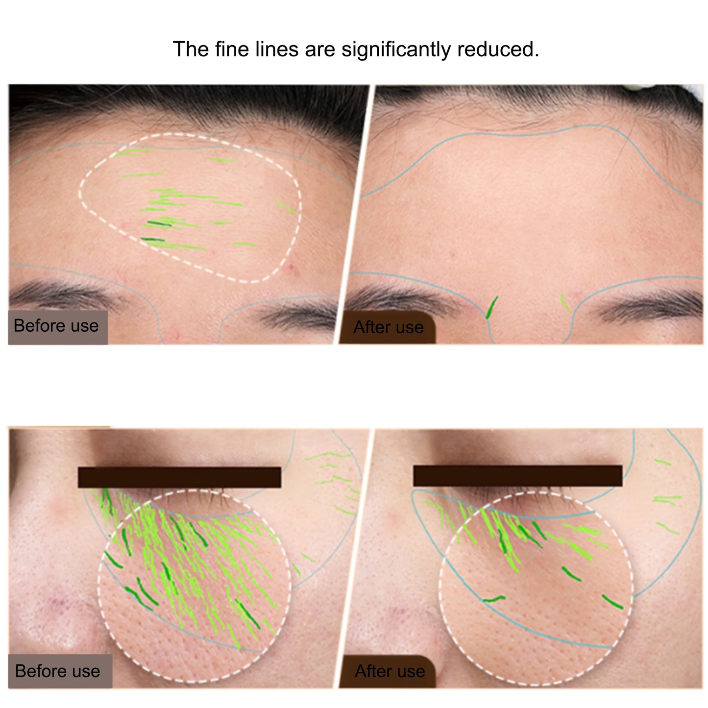EMS Facial & Body RF Machine – Professional Radio Frequency Beauty Device for Skin Tightening, Face Lifting, and Anti-Aging