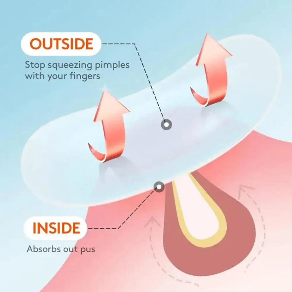 Star Hydrocolloid Acne Patches - Invisible Pimple Spot Stickers for Blemish Coverage and Daily Skincare