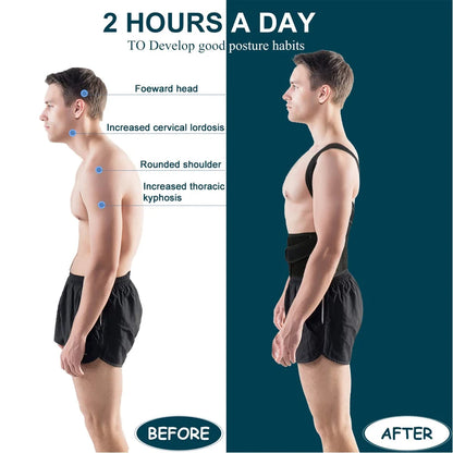 Back Brace Posture Corrector — Adjustable Back Straightener for Women & Men | Scoliosis & Hunchback Correction Posture Trainer