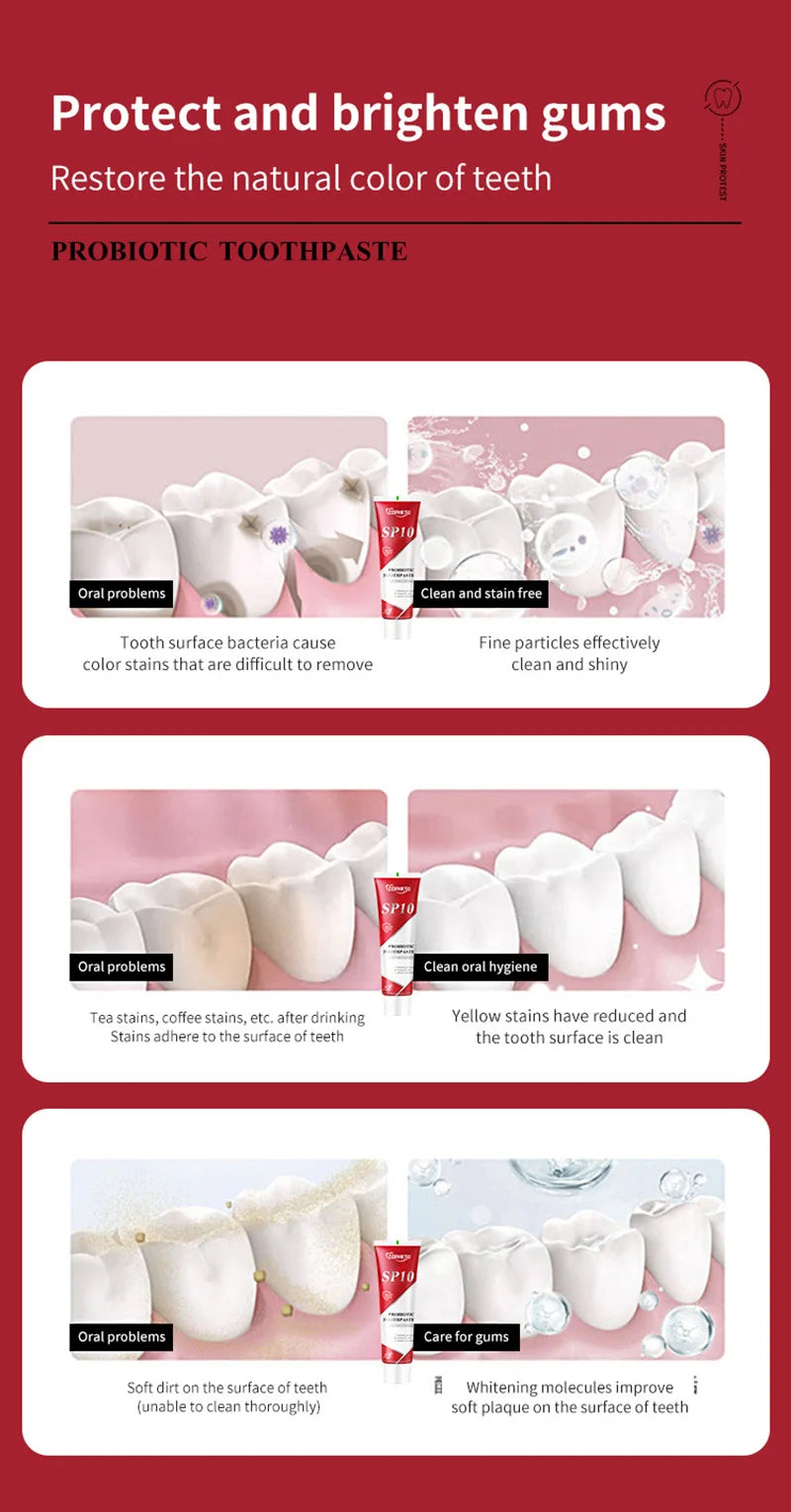 SP-10 Fresh Breath & Whitening Toothpaste – Removes Plaque, Yellow Stains & Supports Gum Health for Oral Care