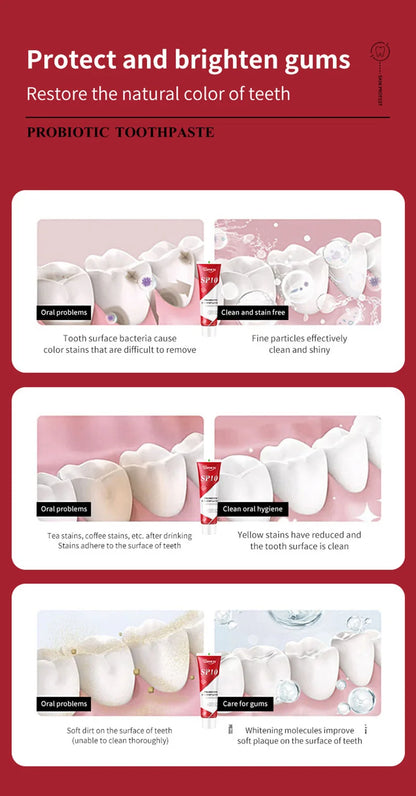 SP-10 Fresh Breath & Whitening Toothpaste – Removes Plaque, Yellow Stains & Supports Gum Health for Oral Care
