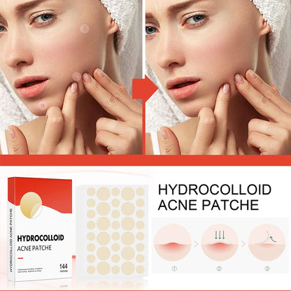 144PCS Acne Pimple Patches - Invisible Hydrocolloid Spot Covers in 2 Sizes for Face Skin Care