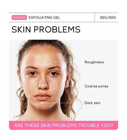 Sakura Exfoliating Peeling Gel — Moisturizing Nourishing Facial Scrub Cream for Skin Care, 30g/50g