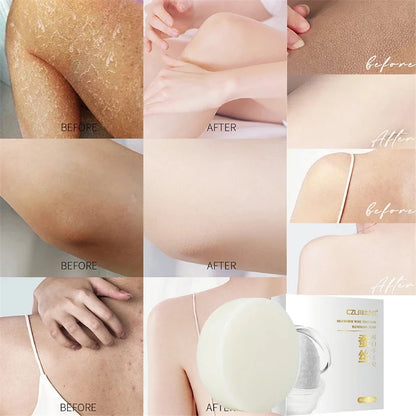 Body Whitening Soap – Underarm & Knee Bleaching, Dark Spot Removal, Chicken Skin Treatment, Dead Skin Exfoliating & Moisturizing