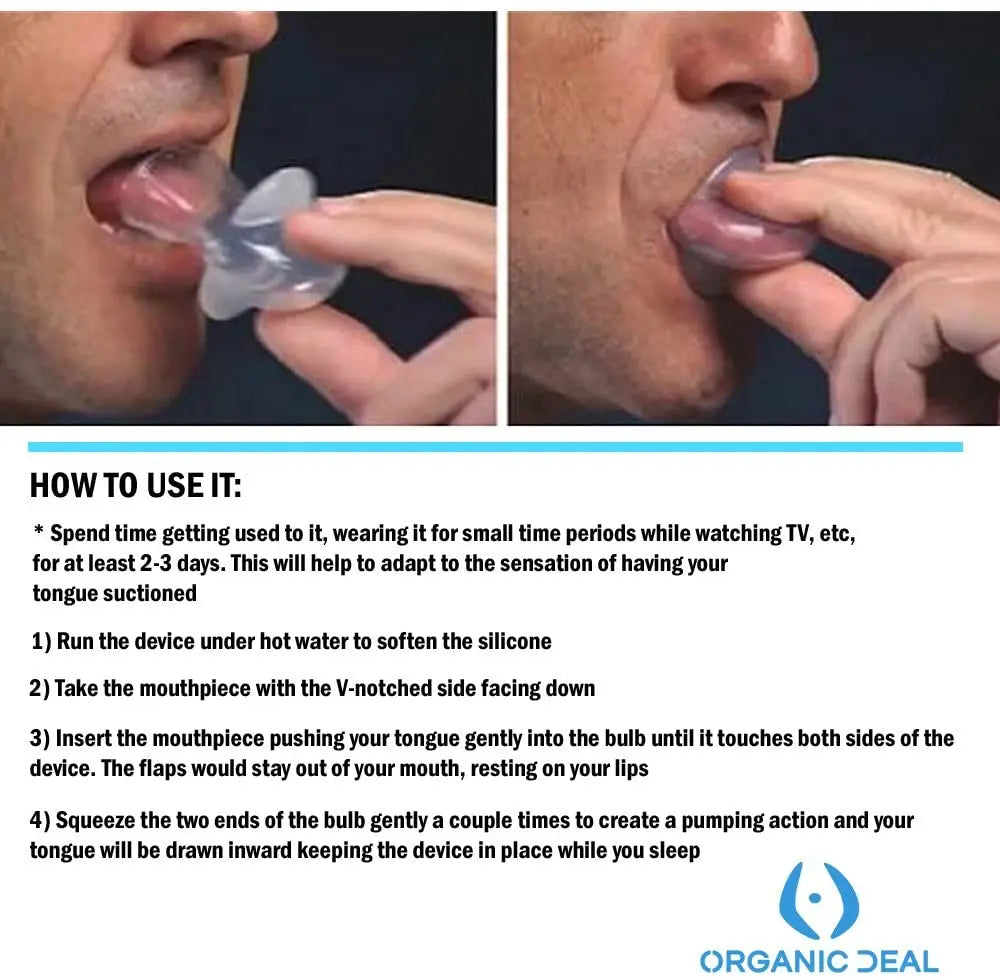Anti-Snoring Silicone Mouthpiece – Tongue Retainer Device for Snore & Sleep Apnea Relief