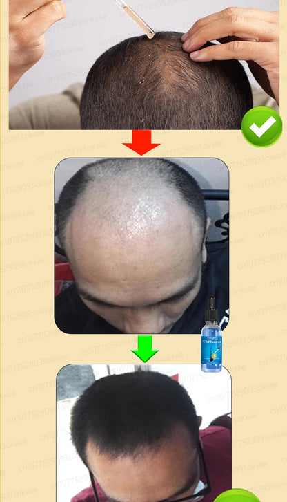 WPRBREGT Blue Hair Growth Serum — Essential Oil for Thicker Hair, Anti-Baldness Treatment