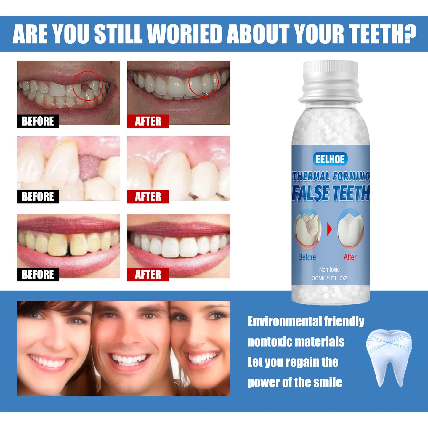 Resin False Teeth & Solid Gums — Temporary Filling Material for Dentistry, Oral Care, Denture Restoration 20/30ml