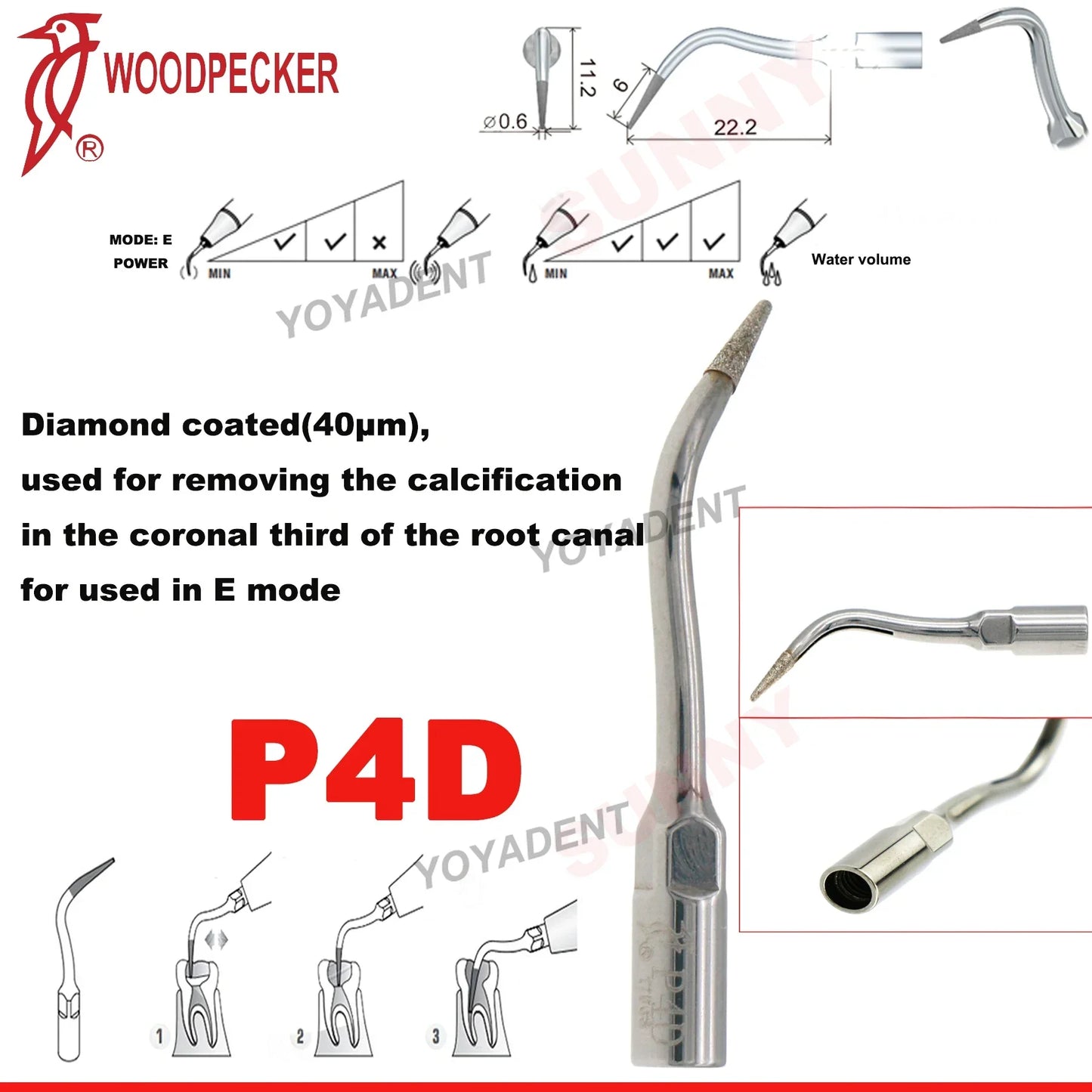 Woodpecker Dental Scaler Tips – Ultrasonic Tooth Cleaning, Endo & Perio Scaling Tips, Fit EMS UDS Scaler Handpiece