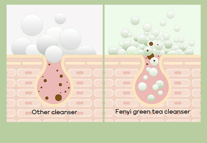 Vitamin C Facial Cleanser — Deep Cleansing, Moisturizing Face Wash Foam, Blackhead Removal Skincare