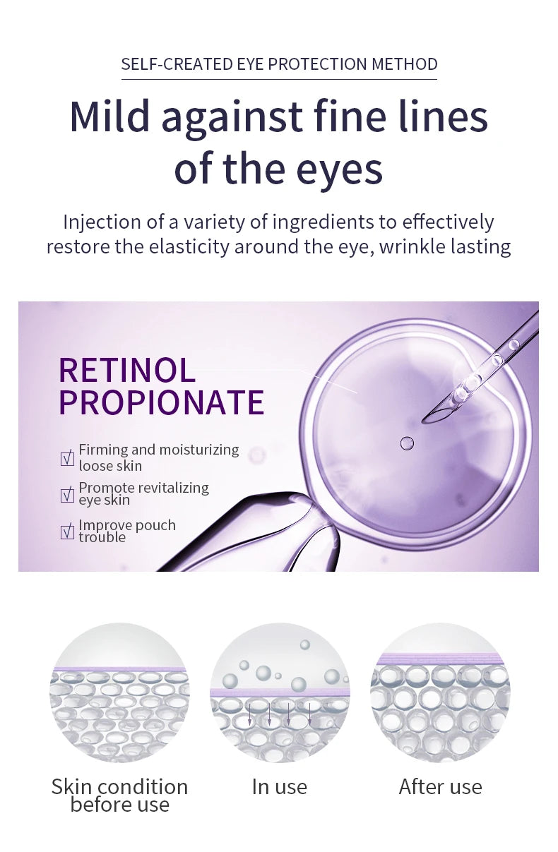 O'CHEAL Anti-Wrinkle Eye Cream Roller – Dark Circle & Puffiness Reducer with Hyaluronic Acid for Anti-Aging Skin Care