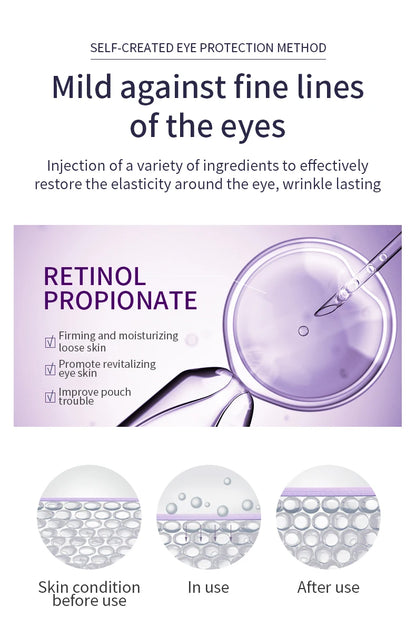 O'CHEAL Anti-Wrinkle Eye Cream Roller – Dark Circle & Puffiness Reducer with Hyaluronic Acid for Anti-Aging Skin Care