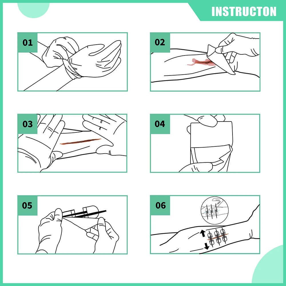 RHINO RESCUE Zip Stitch Wound Closure Kit – Dressings & Strips for Cut Care