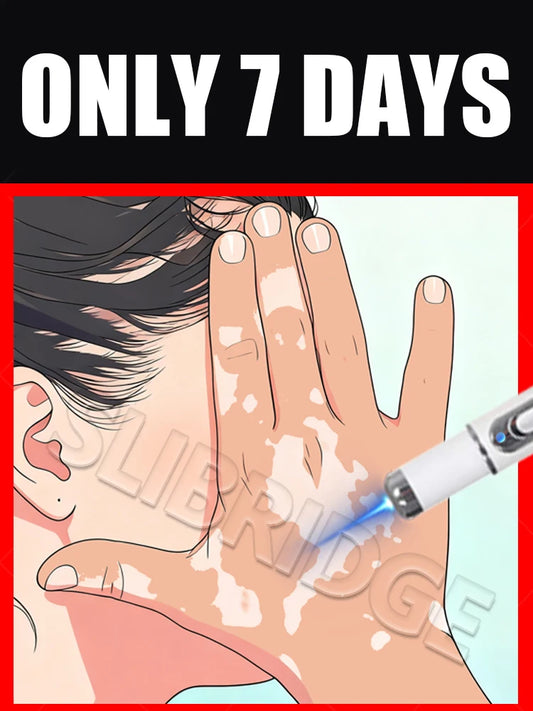 2025 Upgraded Blue Light Pen – Vitiligo Treatment Tool