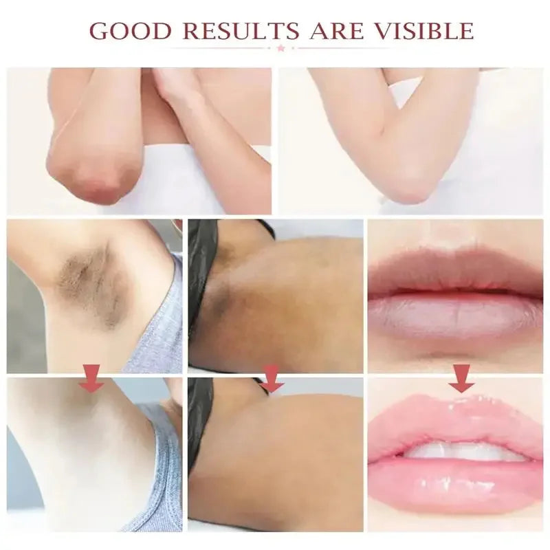 Underarm & Intimate Area Brightening Cream - Moisturizing Korean-Inspired Skincare for Uneven-Looking Skin Tone